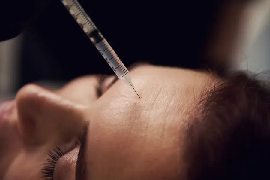 A wrinkle-relaxer injection to the upper face for a brow lift at a Thonotosassa, FL medical spa