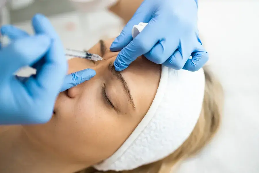 A wrinkle-relaxer injection treating frown lines between the brows at SpaRx Medical Aesthetics in Thonotosassa, FL