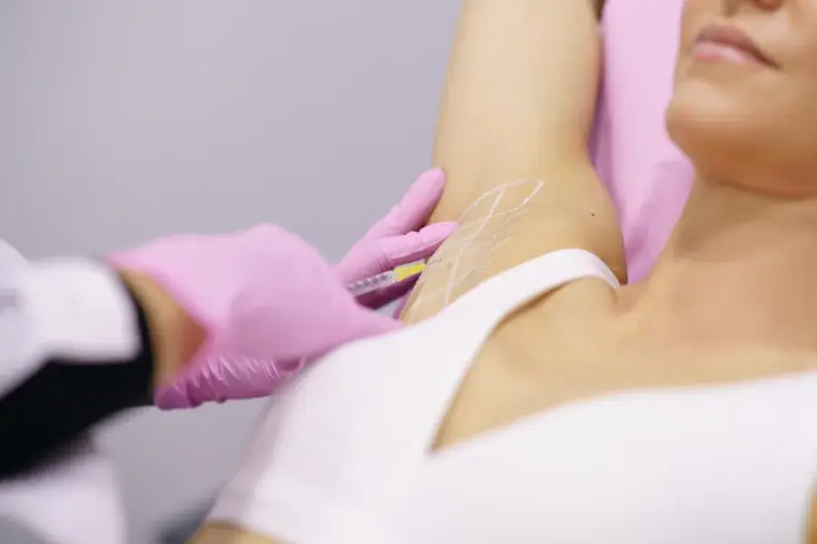An underarm wrinkle-relaxer injection to treat excessive sweating at SpaRx Medical Aesthetics in Thonotosassa, FL